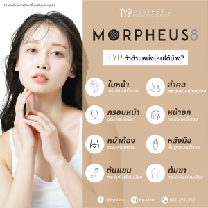 morpheus8 ทำจุดไหนได้บ้าง TYP