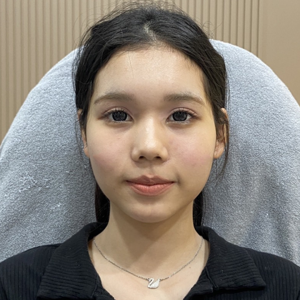 ใต้ตา AFTER - TYP