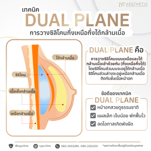 เทคนิค Daul plane - TYP