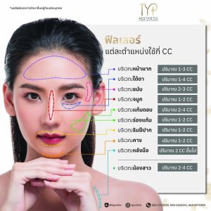 การฉีดฟิลเลอร์ในแต่ละตำแหน่ง ต้องใช้กี่ CC ?
