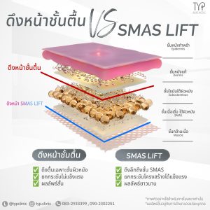Smas