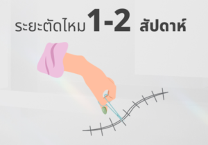 ตัดไหมหนังหน้าท้อง