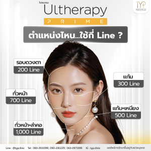 Ultherapy Prime ตำแหน่งไหน ใช้กี่ Line ?